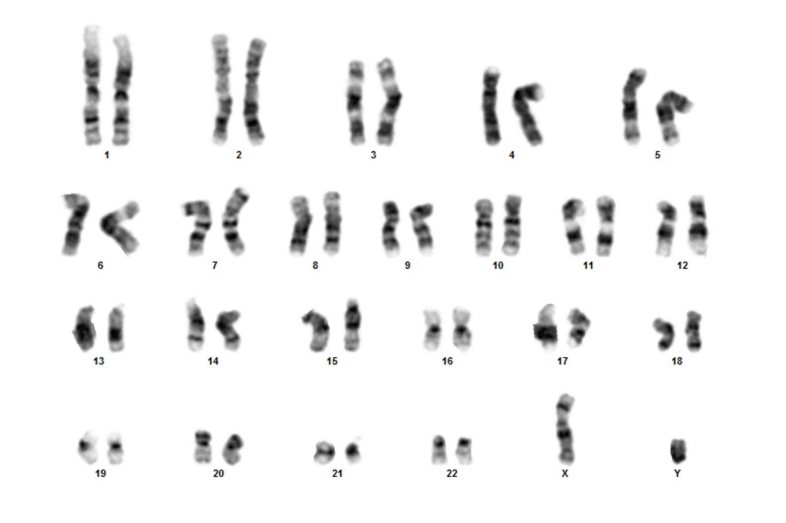 Karyotype visual